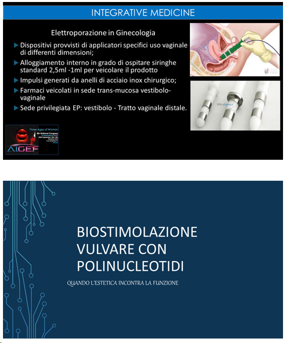 biostimolazione vulvale